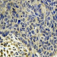 MSRB2 / MSRB Antibody