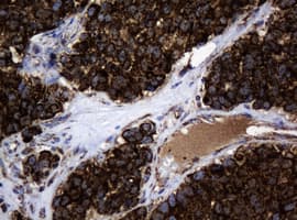 HSPD1 / HSP60 Antibody (clone OTI3G1)