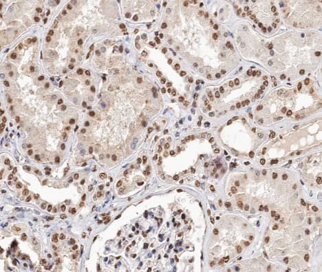 TCEAL8 Antibody