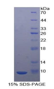 Mouse MIP2 / GRO2 / CXCL2 Protein (Recombinant His)