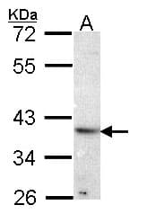 ATP6AP2 / Renin Receptor Antibody