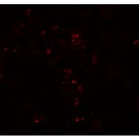 PathPlus™ HES5 Antibody
