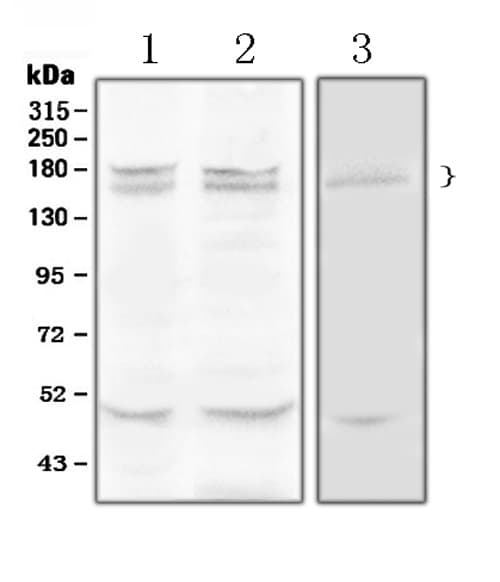 THBS1 / Thrombospondin-1 Antibody