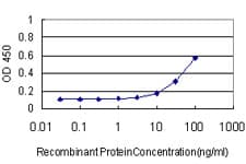 IHC-plus™ MKNK1 / MNK1 Antibody (clone 2H8)