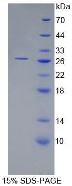 Human ARL15 Protein (Recombinant His-T7)
