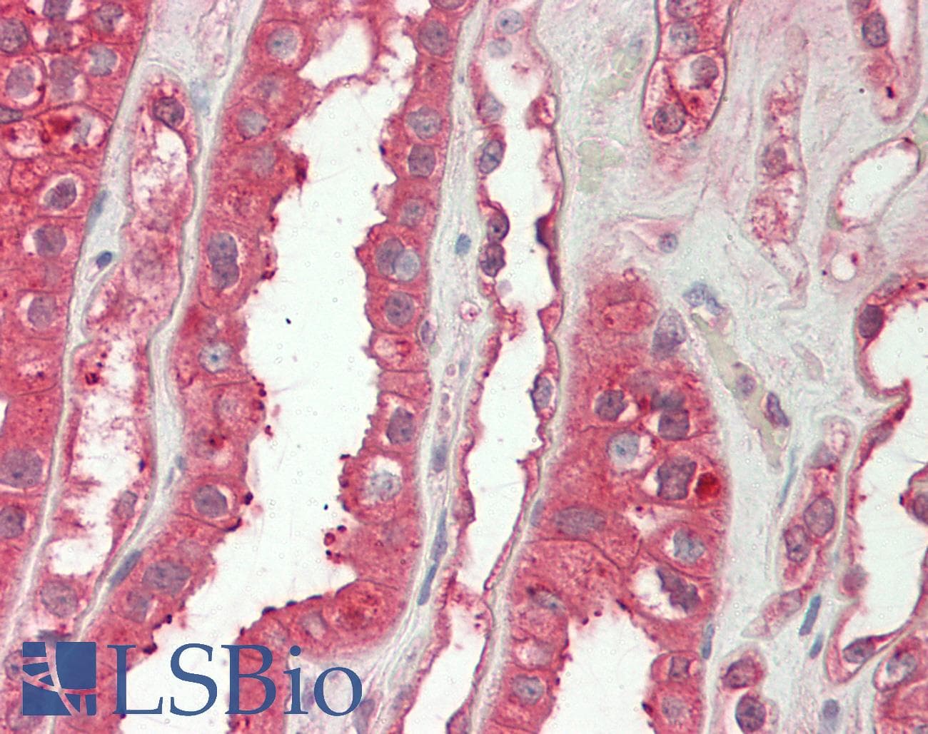 IHC-plus™ PMP70 Antibody