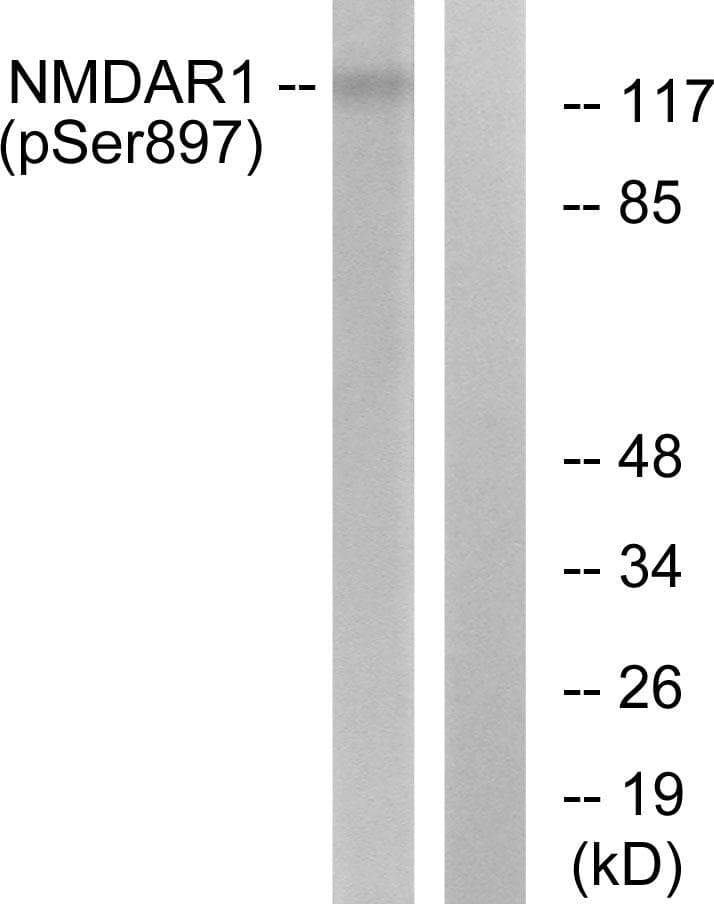 Polyclonal Rabbit anti-Human GRIN1 / NMDAR1 Antibody (phospho-Ser897, IHC, WB)