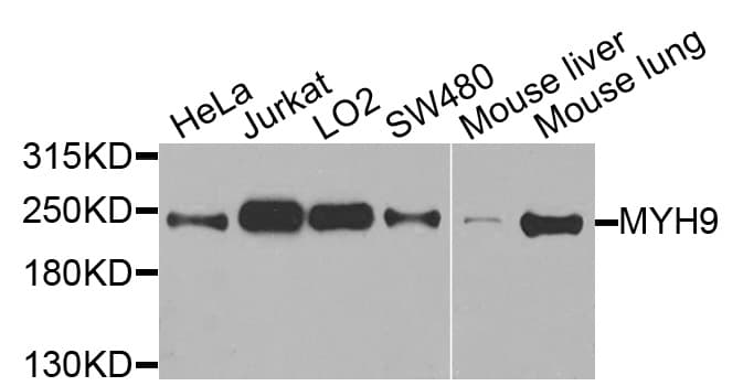 Polyclonal Rabbit anti-Human MYH9 Antibody (IHC, WB)