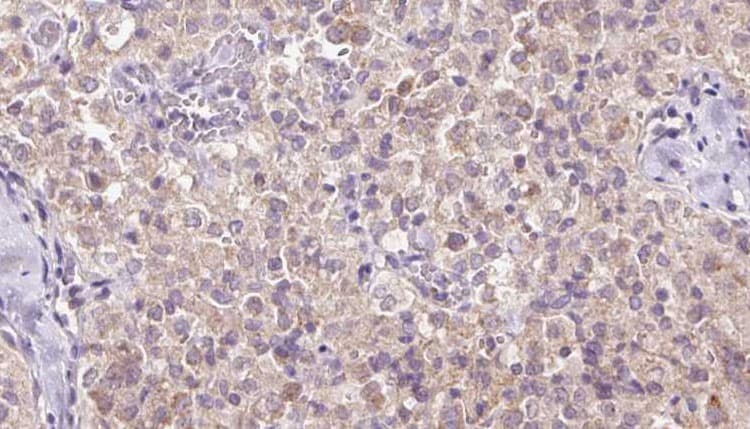 WDR1 Antibody