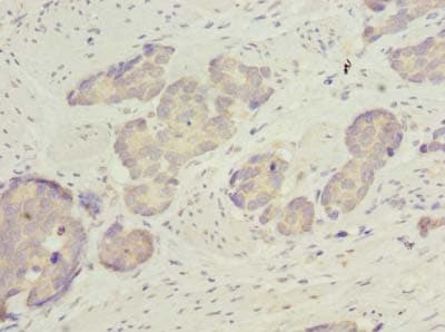 Polyclonal Rabbit anti-Human ACSBG2 Antibody (IHC, WB)