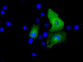 Monoclonal Mouse anti-Human PSMC3 Antibody (clone OTI8G10, Carrier-free, IF, WB)