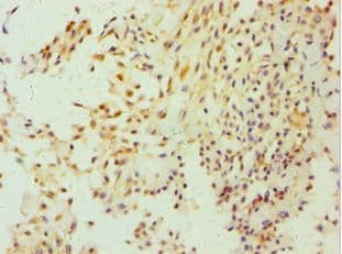 Polyclonal Rabbit anti-Human HBP17 / FGFBP1 Antibody (aa22-232, IHC, WB)