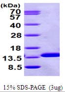 Human B2M / Beta 2 Microglobulin Protein (Recombinant His)