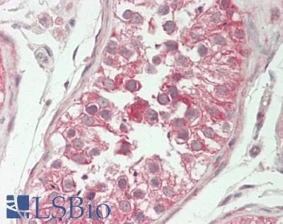 IHC-plus™ TM2D1 / BBP Antibody (Internal)