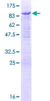 Human WASL / N-WASP Protein (Recombinant GST)