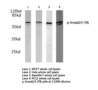 Polyclonal Rabbit anti-Human SMAD2+3 Antibody (phospho-Thr8, WB)