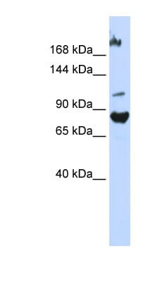 FBXO11 Antibody (C-Terminus)