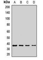 Polyclonal Rabbit anti-Human MC3R / MC3 Receptor Antibody (WB)