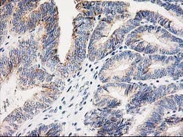 AK4 / Adenylate Kinase 4 Antibody (clone OTI3B1, Carrier-free)