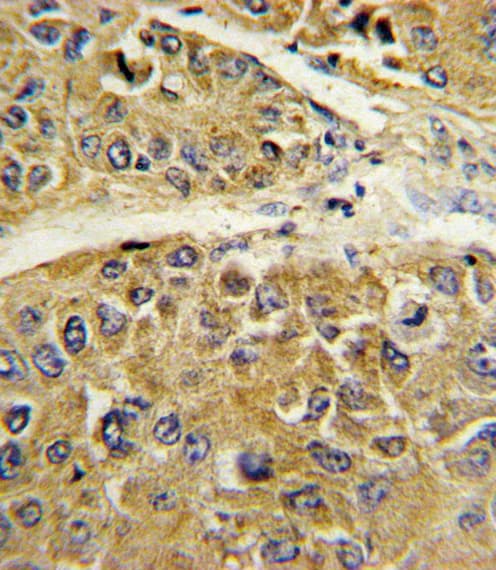 SERPINA7 / TBG Antibody (aa354-383)