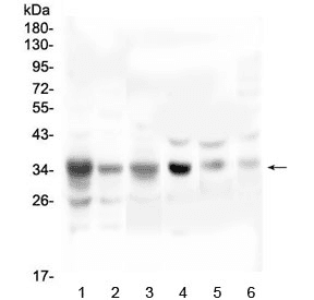 Polyclonal Rabbit anti-Human SFRP1 Antibody (IHC, WB)