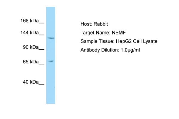 SDCCAG1 / NEMF Antibody (C-Terminus)