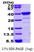 Human BLVRA Protein (Recombinant)