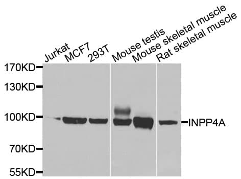 Polyclonal Rabbit anti-Human INPP4A Antibody (IHC, WB)