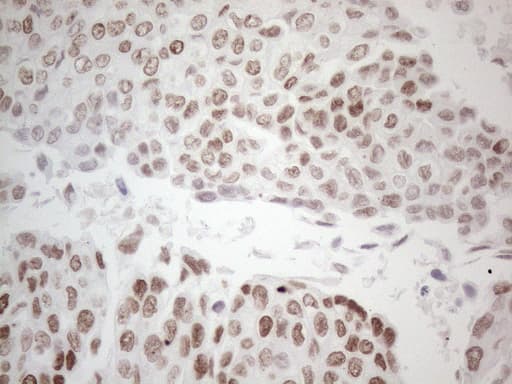 GATA3 Antibody (aa155-443, clone UMAB218)