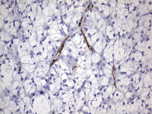 Monoclonal Mouse anti-Human CDH4 / R Cadherin Antibody (clone OTI4F5, aa170-428, IHC, WB)