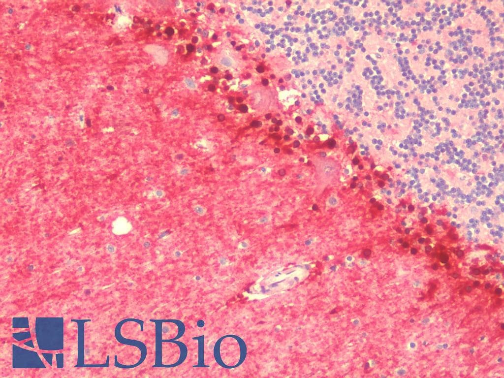 IHC-plus™ CCDC141 Antibody