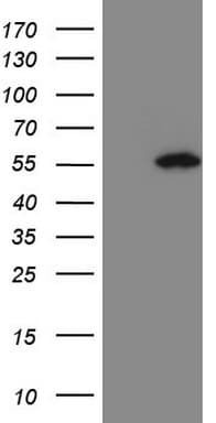 PELI1 / Pellino 1 Antibody (aa1-245, clone OTI13F8)