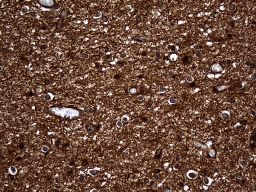 GNPAT / DHAP-AT Antibody (clone OTI4G9)