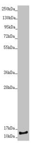 Polyclonal Rabbit anti-Human NDUFS6 Antibody (IHC, WB)