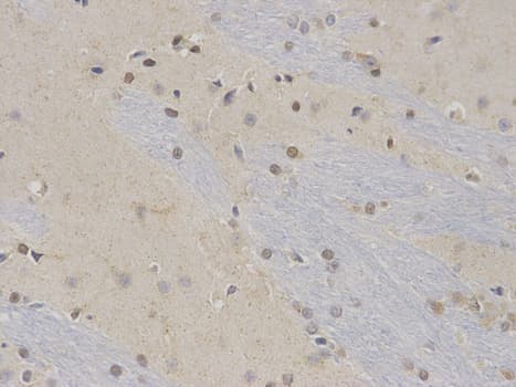 Polyclonal Rabbit anti-Human NR0B2 Antibody (IHC, IF, WB)