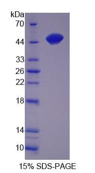 Mouse TTPA Protein (Recombinant His-S)