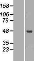 ACADSB Protein (Over-Expression Lysate Myc-DDK (Flag))