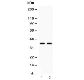 ANXA8 / Annexin A8 Antibody