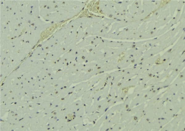 Polyclonal Rabbit anti-Human PAK1IP1 / HPIP1 Antibody (IHC, WB)