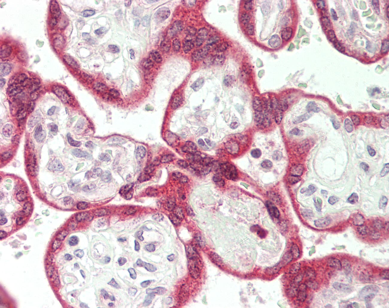 STS / ASC / Steroid Sulfatase Antibody (aa396-445)