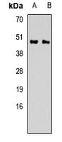 CALU / Calumenin Antibody
