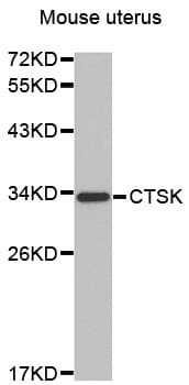 CTSK / Cathepsin K Antibody