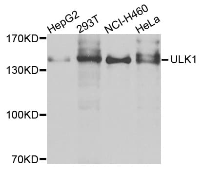 ULK1 Antibody (aa400-499)