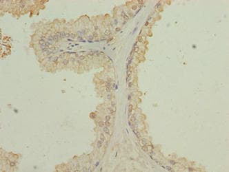 Polyclonal Rabbit anti-Human ZCCHC13 Antibody (IHC)