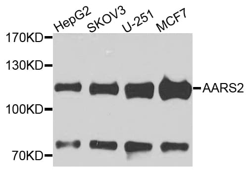 Polyclonal Rabbit anti-Human AARS2 Antibody (IHC, WB)