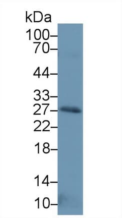 NTF3 / Neurotrophin 3 Antibody (aa21-138, FITC)