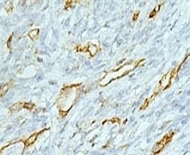 PECAM-1 / CD31 Antibody (clone PCM25-1, Ready-to-Use)