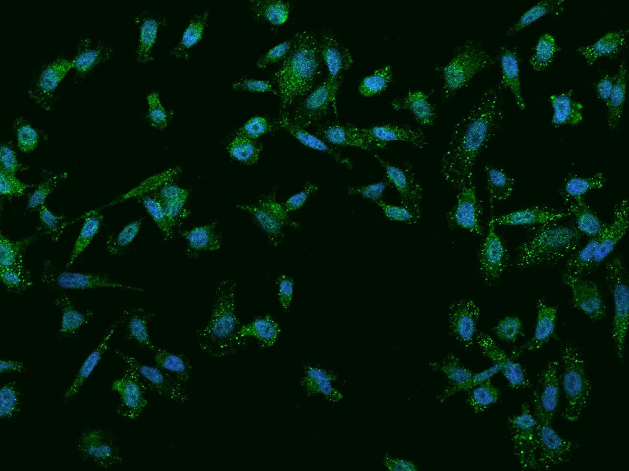 TMEM8B / NGX6 Antibody