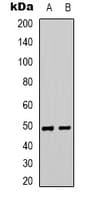 SYNCAM / CADM1 Antibody (C-Terminus)