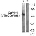 CAMK4 / CaMK IV Antibody (phospho-Thr196/Thr200)